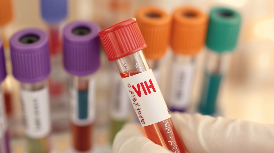 Aumento de casos de VIH en Pereira en 2024